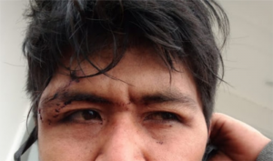 La FLM denuncia racismo hacia comunidades Qom ante la ONU