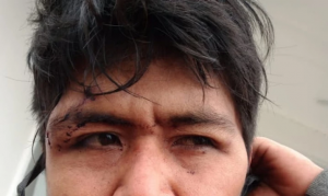 Repudio ante la violencia institucional y el racismo hacia el pueblo Qom en Chaco